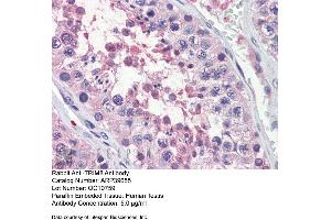 Immunohistochemistry with Human Testis lysate tissue at an antibody concentration of 5. (TRIM8 antibody  (N-Term))