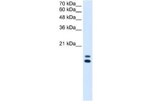 UXT antibody used at 2. (UXT antibody  (N-Term))