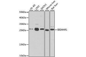 Western blot analysis of extracts of various cell lines, using SIGMAR1 antibody. (SIGMAR1 antibody)