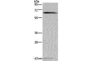 Western blot analysis of Human brain malignant glioma tissue, using NCF2 Polyclonal Antibody at dilution of 1:200 (NCF2 antibody)