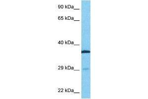 Host:  Rabbit  Target Name:  TTP  Sample Type:  Fetal Lung lysates  Antibody Dilution:  0. (ZFP36 antibody  (N-Term))