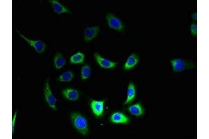 Immunofluorescent analysis of A549 cells using ABIN7160449 at dilution of 1:100 and Alexa Fluor 488-congugated AffiniPure Goat Anti-Rabbit IgG(H+L) (FAM168B antibody  (AA 43-100))