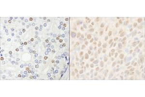 anti-Histone Deacetylase 7 (HDAC7) (AA 902-952) antibody