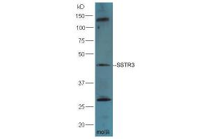 Mouse Brain lysates probed with Rabbit Anti-SSTR3 Polyclonal Antibody, Unconjugated  at 1: 5000 for 90min at 37˚C. (SSTR3 antibody)