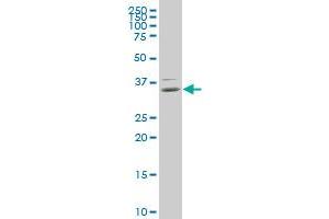 HOXB9 monoclonal antibody (M01), clone 3C8 Western Blot analysis of HOXB9 expression in HepG2 . (HOXB9 antibody  (AA 65-163))