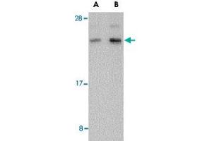 Western blot analysis of BANF1 in human kidney tissue lysate with BANF1 polyclonal antibody  at (A) 0. (BANF1 antibody  (C-Term))