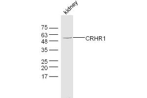Mouse kidney lysates probed with CRHR1 Polyclonal Antibody, Unconjugated  at 1:300 dilution and 4˚C overnight incubation.