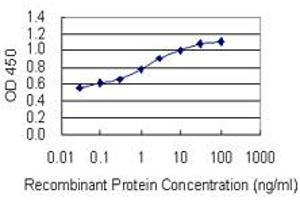 Detection limit for recombinant GST tagged GPI is 0. (GPI antibody  (AA 1-558))