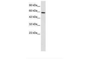 TBC1D10B antibody  (C-Term)