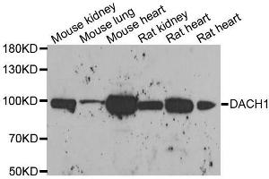 Western blot analysis of extracts of various cell lines, using DACH1 antibody. (DACH1 antibody  (AA 450-570))