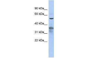RAB3IP antibody used at 1 ug/ml to detect target protein. (RAB3IP antibody)