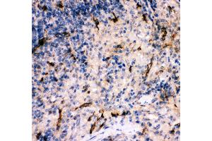 Anti- C5A antibody, IHC(P) IHC(P): Rat Spleen Tissue (C5 antibody  (AA 1-77))