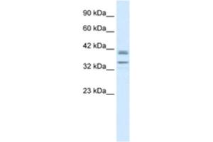 Western Blotting (WB) image for anti-One Cut Homeobox 3 (ONECUT3) antibody (ABIN2460969) (ONECUT3 antibody)