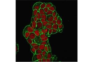 Immunofluorescence Analysis of PFA-fixed MCF-7 cells. (CD47 antibody)