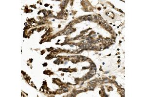 IHC analysis of TXNIP using anti-TXNIP antibody (ABIN7601882). (TXNIP antibody  (AA 5-391))
