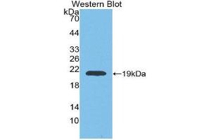 Western Blotting (WB) image for anti-Matrix Metallopeptidase 9 (Gelatinase B, 92kDa Gelatinase, 92kDa Type IV Collagenase) (MMP9) (AA 226-391) antibody (ABIN1078311)