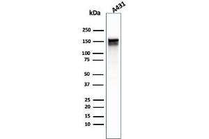 Western Blot Analysis of A431 cell lysate using EGFR Mouse Monoclonal Antibody (GFR/1667). (EGFR antibody)