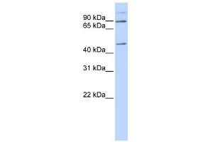 C21ORF13 antibody used at 1 ug/ml to detect target protein.