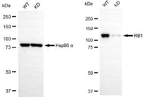 Western blotting analysis using RB1 antibody (ABIN7800184).