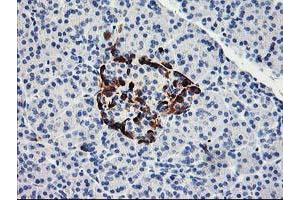 Immunohistochemical staining of paraffin-embedded Human pancreas tissue using anti-ACSS2 mouse monoclonal antibody. (ACSS2 antibody)