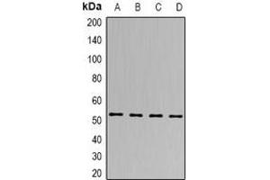 Western blot analysis of SEN2 expression in Hela (A), A549 (B), mouse brain (C), rat heart (D) whole cell lysates. (TSEN2 antibody)