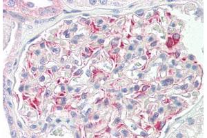 Image no. 3 for anti-STE20-Like Kinase (SLK) (AA 1151-1200) antibody (ABIN2879164) (SLK antibody  (AA 1151-1200))