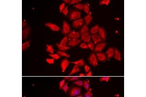 Immunofluorescence analysis of U2OS cells using TMOD4 Polyclonal Antibody (Tropomodulin 4 antibody)