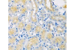 Immunohistochemistry of paraffin-embedded Mouse kidney using CYP4A11 Polyclonal Antibody at dilution of 1:100 (40x lens). (CYP4A11 antibody)