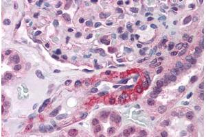 Human Kidney, Vessel: Formalin-Fixed, Paraffin-Embedded (FFPE) (Angiotensin II Type-1 Receptor antibody  (AA 201-250))