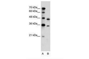 Image no. 2 for anti-phosphoribosyl Pyrophosphate Synthetase 2 (PRPS2) (AA 168-217) antibody (ABIN6736614) (PRPS2 antibody  (AA 168-217))