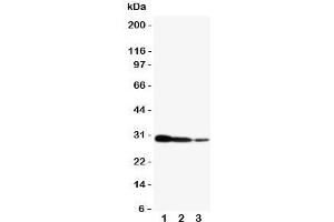 Western blot testing of CRTC2 antibody and human recombinant protein, 29KD with tag;  Lane 1:10ng;  2: 5ng;  3: 2.