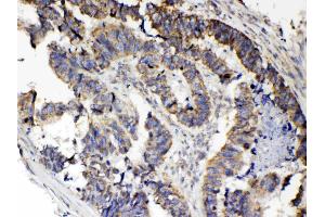 Immunohistochemistry (IHC) image for anti-Tumor Necrosis Factor Receptor Superfamily, Member 11a, NFKB Activator (TNFRSF11A) (AA 235-262), (Middle Region) antibody (ABIN5518884)