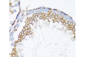 Immunohistochemistry of paraffin-embedded Mouse testis using CTNNA1 Polyclonal Antibody at dilution of 1:100 (40x lens). (CTNNA1 antibody)