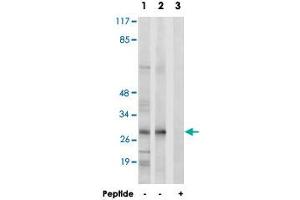 Western blot analysis of extracts from K-562 cells (Lane 1) and RAW 264.