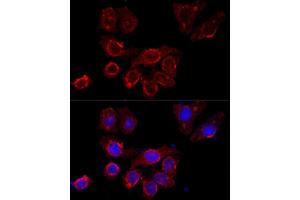 Immunofluorescence analysis of HeLa cells using CSF2RA antibody (ABIN3017509, ABIN3017510, ABIN3017511 and ABIN6220125) at dilution of 1:100 (40x lens). (CSF2RA antibody  (AA 23-150))