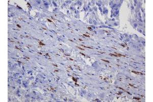 Immunohistochemistry (IHC) image for anti-Sterol O-Acyltransferase 2 (SOAT2) (AA 1-120) antibody (ABIN2715639) (SOAT2 antibody  (AA 1-120))