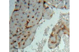 Used in DAB staining on fromalin fixed paraffin-embedded Heart tissue (MAPKAP Kinase 3 antibody  (AA 129-329))