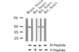 Western blot analysis of Phospho-HDAC8 (Ser39) expression in various lysates (HDAC8 antibody  (pSer39))