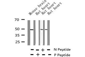 Western blot analysis of Phospho-HDAC8 (Ser39) expression in various lysates