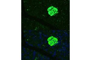 Immunofluorescence analysis of mouse pancreas using SFRP5 Polyclonal Antibody (ABIN7270181) at dilution of 1:100 (40x lens). (SFRP5 antibody  (AA 30-317))