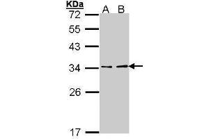 WB Image Sample (30 ug of whole cell lysate) A: Hep G2 , B: Molt-4 , 12% SDS PAGE antibody diluted at 1:1000