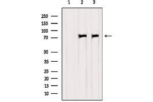 Western blot analysis of extracts from various samples, using PKC delta Antibody.