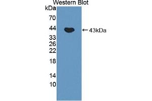 Detection of Recombinant FECH, Human using Polyclonal Antibody to Ferrochelatase (FECH) (FECH antibody  (AA 55-423))