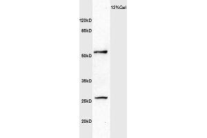 Human colon carcinoma lysate probed with Anti MMP1 Polyclonal Antibody, Unconjugated  at 1:3000 for 90 min at 37˚C. (MMP1 antibody  (AA 401-469))