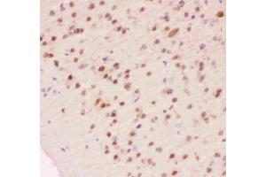 Immunohistochemistry (IHC) image for anti-Apurinic/Apyrimidinic Endonuclease 1 (APEX1) (AA 2-318) antibody (ABIN3043785)