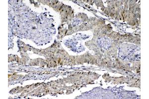 IHC analysis of MED9 using anti-MED9 antibody . (MED9 antibody  (AA 55-146))