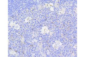 Immunohistochemistry of paraffin-embedded human tonsil using CASP3 antibody (ABIN4903137) at dilution of 1:100 (40x lens).
