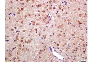 Formalin-fixed and paraffin embedded rat brain labeled with Anti-TNIP2 Polyclonal Antibody, Unconjugated (ABIN872901) at 1:200 followed by conjugation to the secondary antibody and DAB staining (TNIP2 antibody  (AA 85-180))