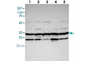 Western blot analysis of Lane 1: RT-4, Lane 2: EFO-21, Lane 3: U-138 MG, Lane 4: Liver, Lane 5: Tonsil with PSMA3 polyclonal antibody . (PSMA3 antibody)