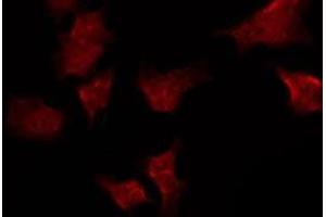 ABIN6275478 staining Hela by IF/ICC. (RGS10 antibody  (Internal Region))